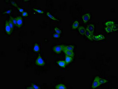 CHAT Antibody