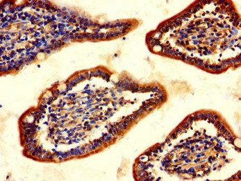 CHAT Antibody
