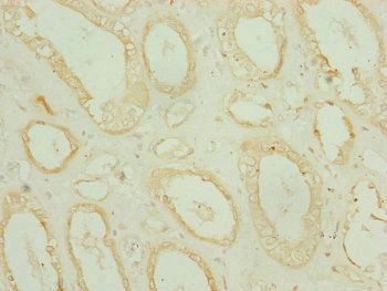 CHCHD3 Antibody
