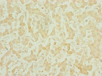 CHCHD3 Antibody