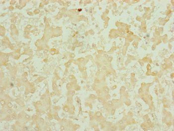 CHCHD3 Antibody