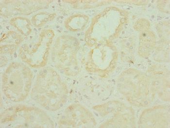 CHCHD3 Antibody