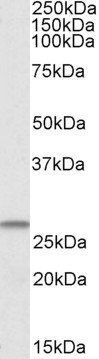 CHCHD3 Antibody