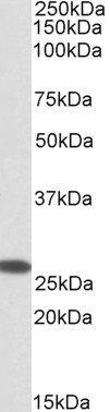 CHCHD3 (aa151-164) Antibody