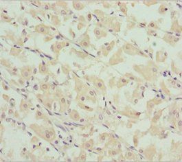 CHIC2 Antibody