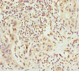 CHIC2 Antibody