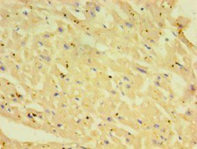 CHI3L2 Antibody