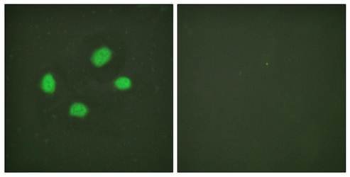 Chk2 (Phospho-Thr383) Antibody