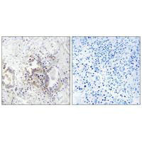 CHML Antibody
