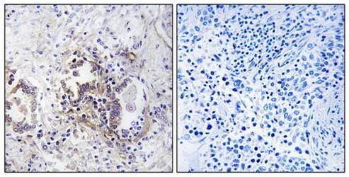 CHML Antibody