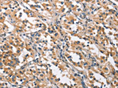 CHMP1A Antibody
