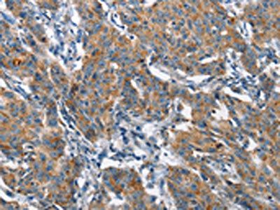 CHMP1A Antibody