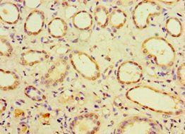 CHMP1B Antibody