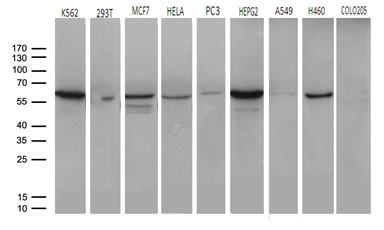 CHMP5 Antibody