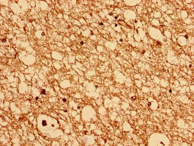 CHMP6 Antibody