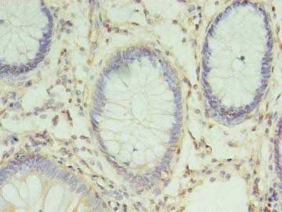 CHMP6 Antibody