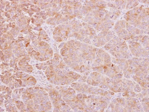 Calcium binding protein p22 antibody [N2C2], Internal