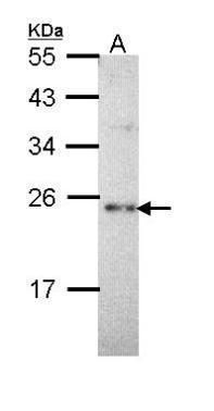Calcium binding protein p22 antibody [N2C2], Internal