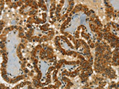 CHRDL2 Antibody