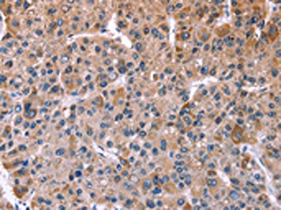 CHRM1 Antibody