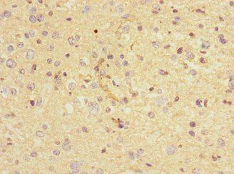 CHRNA9 Antibody
