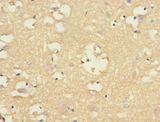 CHRNA9 Antibody