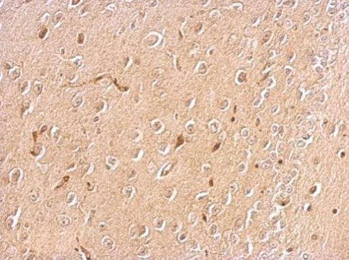 Chromogranin C Rabbit Polyclonal Antibody