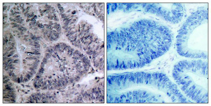 CHUK Antibody
