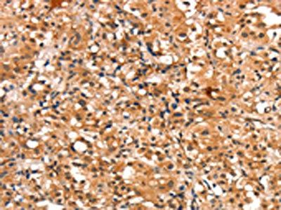 CHUK Antibody