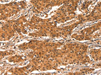 CHUK Antibody