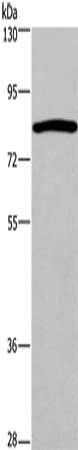 CHUK Antibody