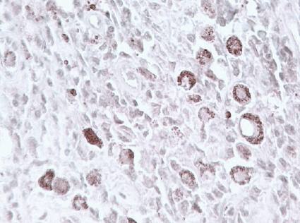 Sheep anti Human chx 10 (Visual system homeobox 2) (CT) Antibody