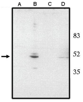 Sheep anti Human chx 10 (Visual system homeobox 2) (NT) Antibody