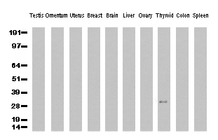 CIB1 Antibody