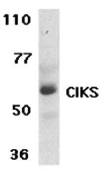 CIKS Rabbit Polyclonal Antibody