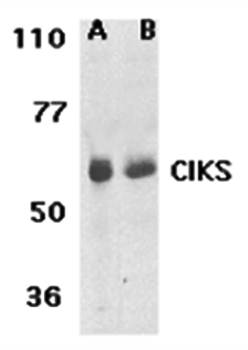CIKS Rabbit Polyclonal Antibody