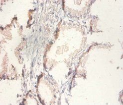 CS Antibody