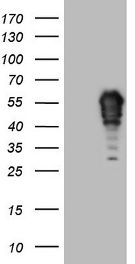 CSNK1E Antibody