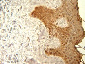 Pan-Cytokeratin, 2 Clones (AE1/AE3) Antibody