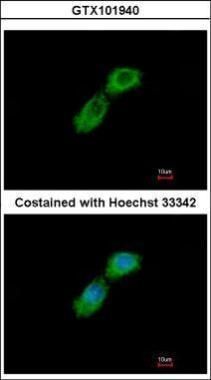 CKAP1 Rabbit Polyclonal Antibody