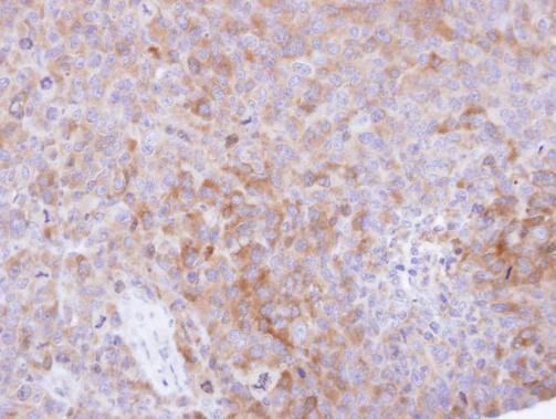 CKAP1 Rabbit Polyclonal Antibody