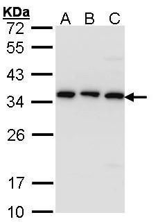 CKAP1 Rabbit Polyclonal Antibody