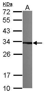 CKAP1 Rabbit Polyclonal Antibody