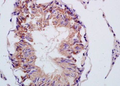 CMTM2 Rabbit Polyclonal Antibody