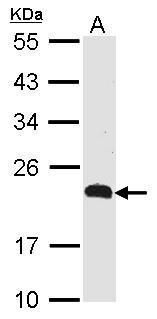 PCBP2 Rabbit Polyclonal Antibody
