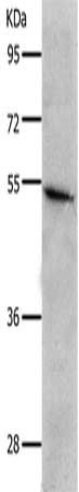 CKMT1A Antibody