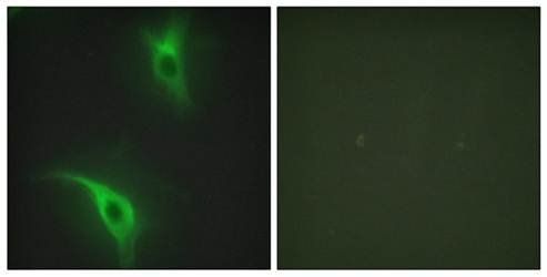 CKS1 Antibody