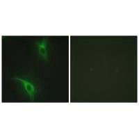 CKS1B Antibody