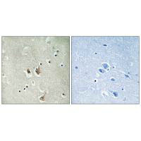 CKS2 Antibody