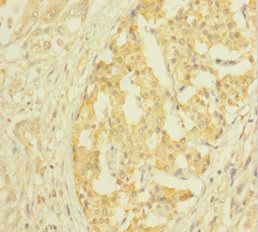 CLTB Antibody